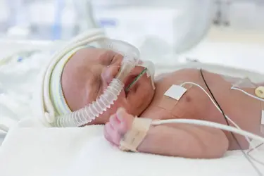 cvp_invasive_bp_intubation_billing